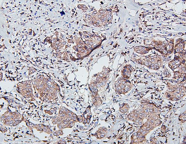 2 - Anti-SDHB Antibody Picoband™ (monoclonal, 2I3) ABO14874