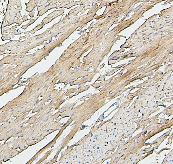 2 - Anti-SDHB Antibody Picoband™ (monoclonal, 2I3) ABO14874