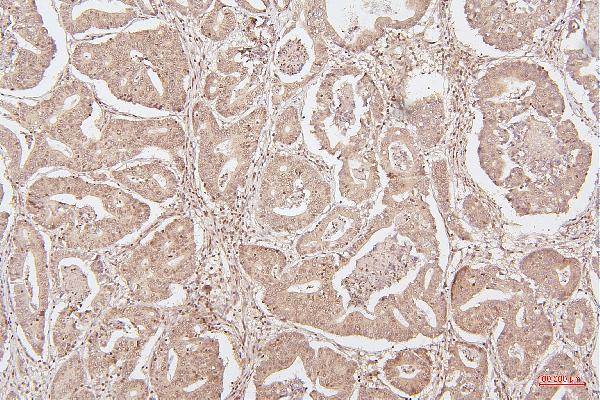 2 - Anti-HMGB1 Antibody Picoband™ (monoclonal, 5H3) ABO14876