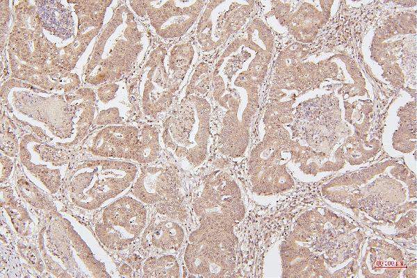 2 - Anti-HMGB1 Antibody Picoband™ (monoclonal, 5H3) ABO14876