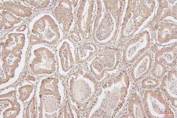 2 - Anti-HMGB1 Antibody Picoband™ (monoclonal, 5H3) ABO14876