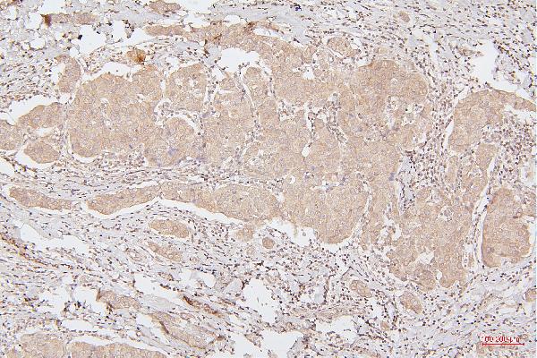 2 - Anti-HMGB1 Antibody Picoband™ (monoclonal, 5H3) ABO14876