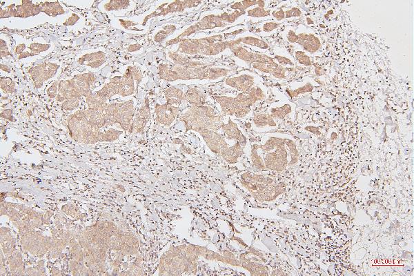 2 - Anti-HMGB1 Antibody Picoband™ (monoclonal, 5H3) ABO14876