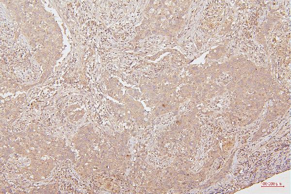 2 - Anti-HMGB1 Antibody Picoband™ (monoclonal, 5H3) ABO14876