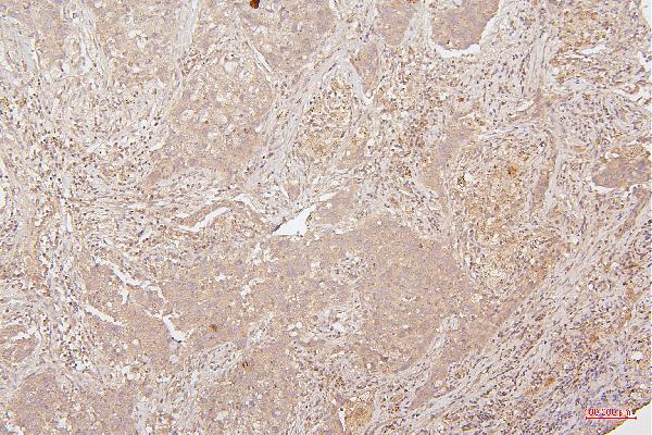 2 - Anti-HMGB1 Antibody Picoband™ (monoclonal, 5H3) ABO14876