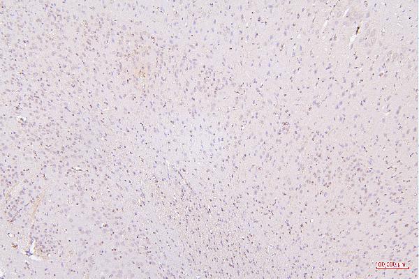 2 - Anti-HMGB1 Antibody Picoband™ (monoclonal, 5H3) ABO14876