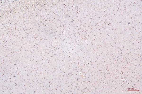 2 - Anti-HMGB1 Antibody Picoband™ (monoclonal, 5H3) ABO14876