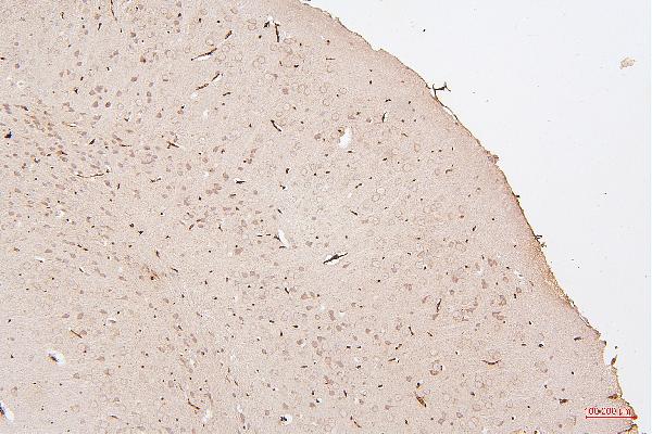 2 - Anti-HMGB1 Antibody Picoband™ (monoclonal, 5H3) ABO14876