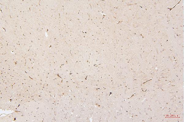 2 - Anti-HMGB1 Antibody Picoband™ (monoclonal, 5H3) ABO14876