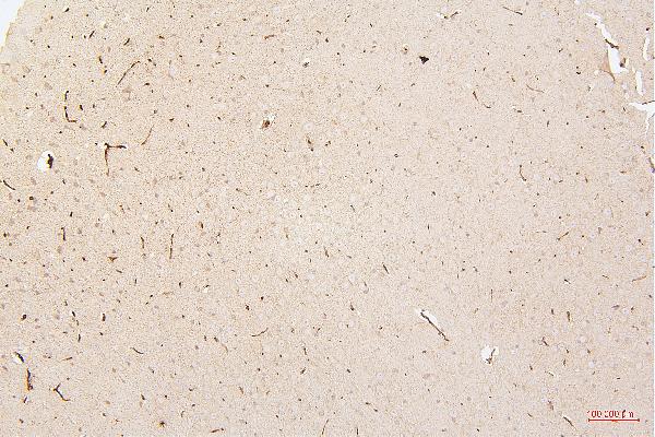 2 - Anti-HMGB1 Antibody Picoband™ (monoclonal, 5H3) ABO14876
