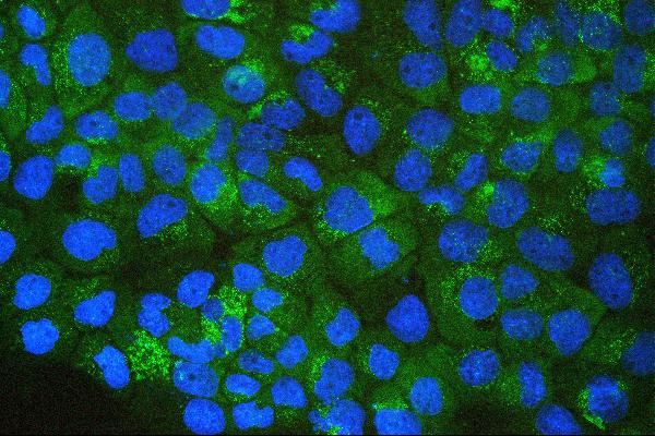 3 - Anti-SQSTM1/p62 Antibody Picoband™ (monoclonal, 3H11) ABO14877