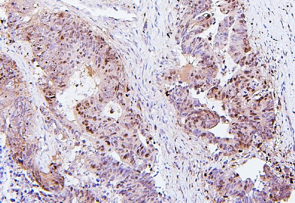 2 - Anti-SQSTM1/p62 Antibody Picoband™ (monoclonal, 3H11) ABO14877
