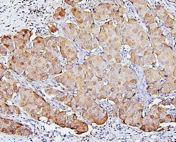 2 - Anti-SQSTM1/p62 Antibody Picoband™ (monoclonal, 3H11) ABO14877