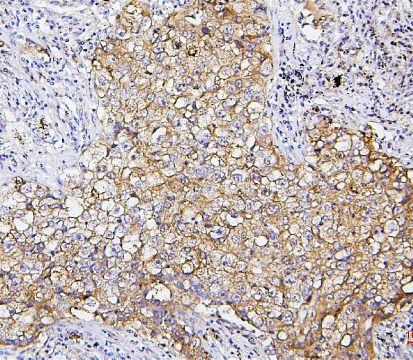 2 - Anti-SQSTM1/p62 Antibody Picoband™ (monoclonal, 3H11) ABO14877