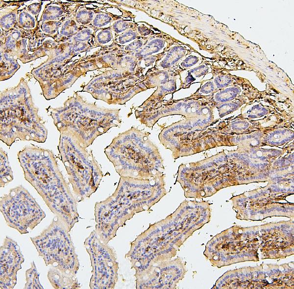 2 - Anti-SQSTM1/p62 Antibody Picoband™ (monoclonal, 3H11) ABO14877