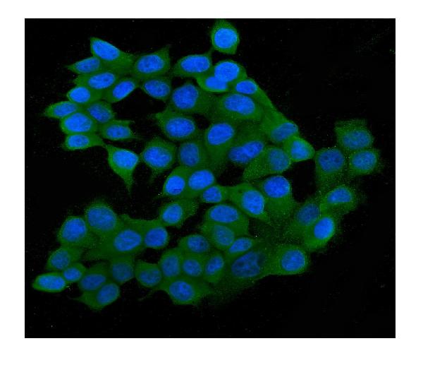 3 - Anti-SQSTM1/p62 Antibody Picoband™ (monoclonal, 3H11) ABO14877