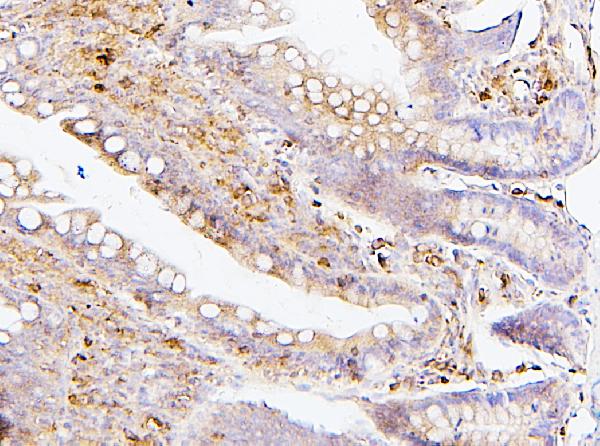 2 - Anti-SQSTM1/p62 Antibody Picoband™ (monoclonal, 3H11) ABO14877