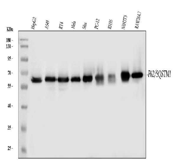 1 - Anti-SQSTM1/p62 Antibody Picoband™ (monoclonal, 3H11) ABO14877