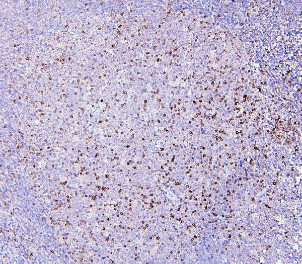 2 - Anti-RAB27A Antibody Picoband™ (monoclonal, 2F5) ABO14878