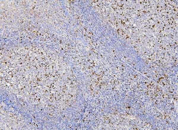 2 - Anti-RAB27A Antibody Picoband™ (monoclonal, 2F5) ABO14878