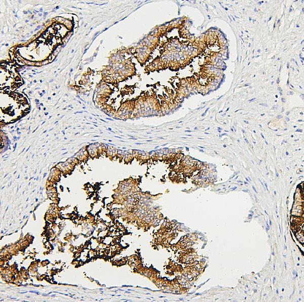 2 - Anti-RAB27A Antibody Picoband™ (monoclonal, 2F5) ABO14878
