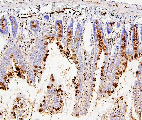 2 - Anti-RAB27A Antibody Picoband™ (monoclonal, 2F5) ABO14878
