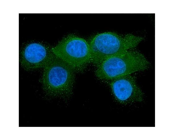 3 - Anti-RAB27A Antibody Picoband™ (monoclonal, 2F5) ABO14878