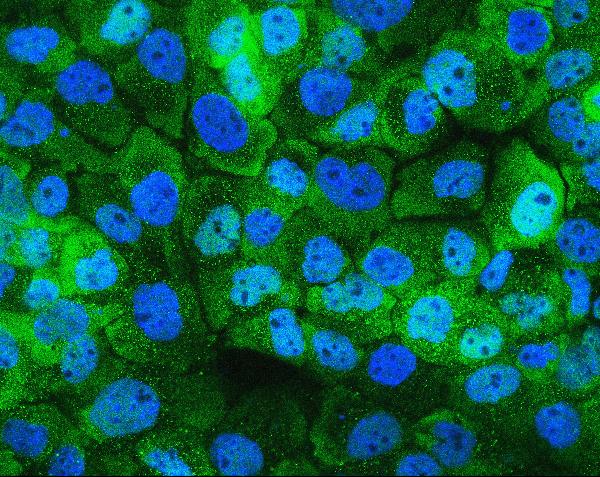 3 - Anti-Hsp105/HSPH1 Antibody Picoband™ (monoclonal, 3D10) ABO14879