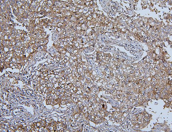 2 - Anti-Hsp105/HSPH1 Antibody Picoband™ (monoclonal, 3D10) ABO14879