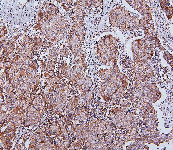 2 - Anti-Hsp105/HSPH1 Antibody Picoband™ (monoclonal, 3D10) ABO14879
