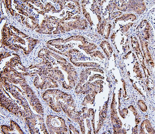 2 - Anti-Hsp105/HSPH1 Antibody Picoband™ (monoclonal, 3D10) ABO14879