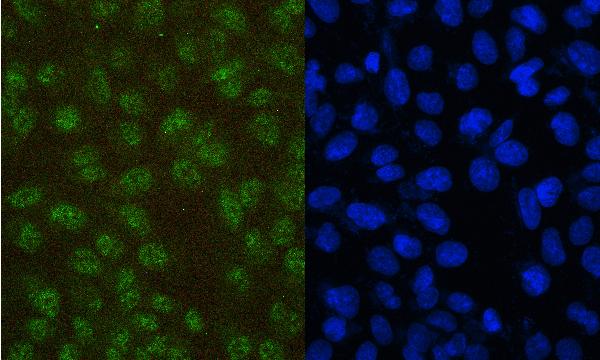 3 - Anti-PAX5 Antibody Picoband™ (monoclonal, 6I4) ABO14881