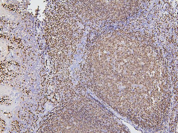 2 - Anti-PAX5 Antibody Picoband™ (monoclonal, 6I4) ABO14881