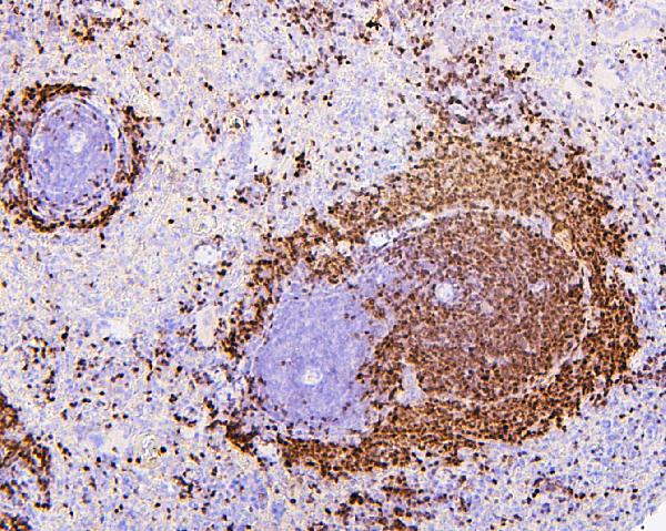 2 - Anti-PAX5 Antibody Picoband™ (monoclonal, 6I4) ABO14881