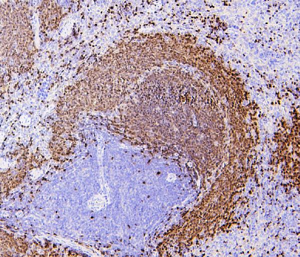 2 - Anti-PAX5 Antibody Picoband™ (monoclonal, 6I4) ABO14881