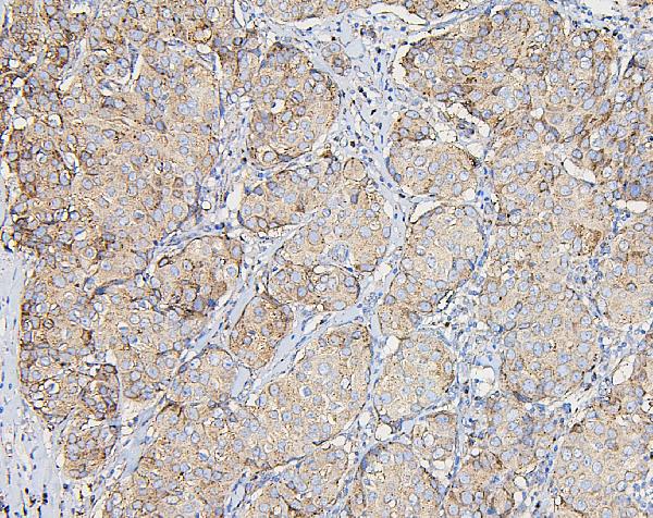 2 - Anti-COPE Antibody Picoband™ (monoclonal, 9B6) ABO14882