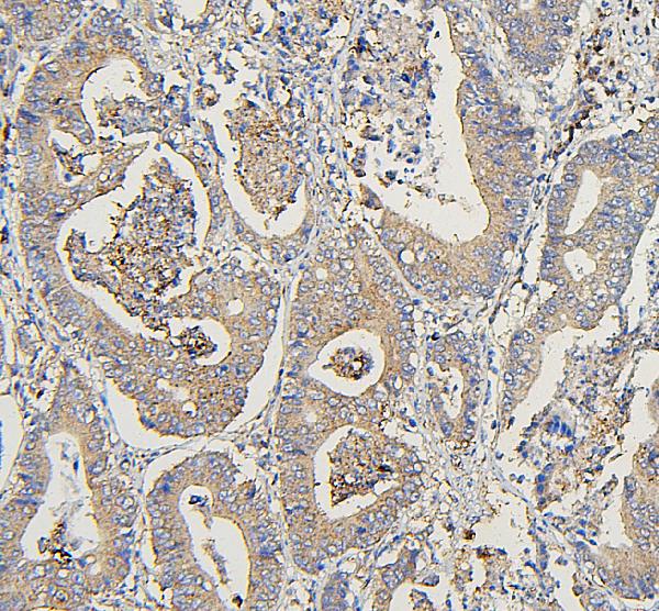 2 - Anti-COPE Antibody Picoband™ (monoclonal, 9B6) ABO14882