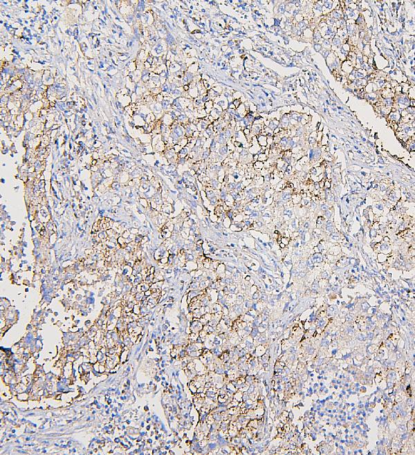 2 - Anti-COPE Antibody Picoband™ (monoclonal, 9B6) ABO14882