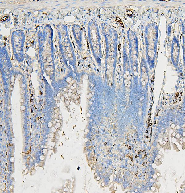 2 - Anti-COPE Antibody Picoband™ (monoclonal, 9B6) ABO14882