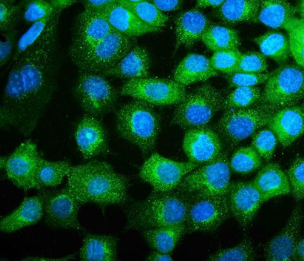 3 - Anti-COPE Antibody Picoband™ (monoclonal, 9B6) ABO14882