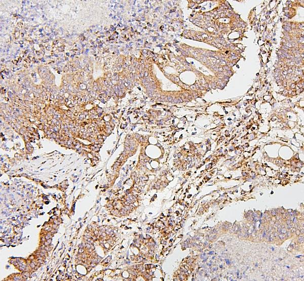 2 - Anti-SDHB Antibody Picoband™ (monoclonal, 11I3) ABO14883