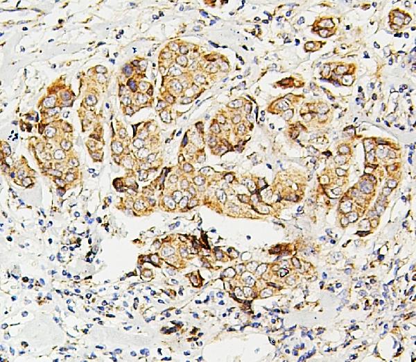 2 - Anti-SDHB Antibody Picoband™ (monoclonal, 11I3) ABO14883