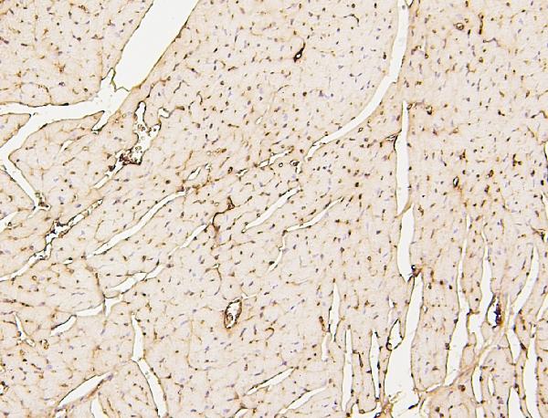 2 - Anti-SDHB Antibody Picoband™ (monoclonal, 11I3) ABO14883