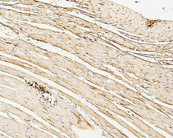 2 - Anti-SDHB Antibody Picoband™ (monoclonal, 11I3) ABO14883