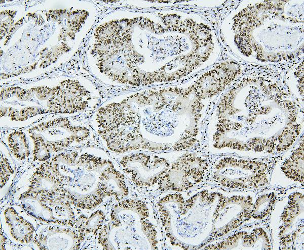 2 - Anti-NRF1 Antibody Picoband™ (monoclonal, 2G4) ABO14884