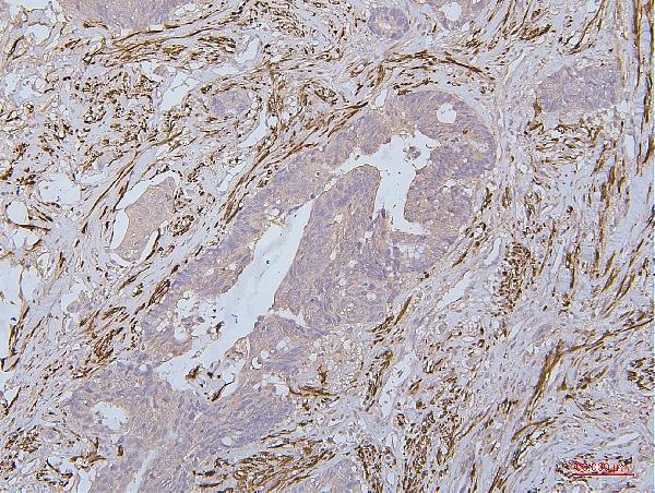 2 - Anti-Desmin Antibody Picoband™ (monoclonal, 2B5) ABO14885