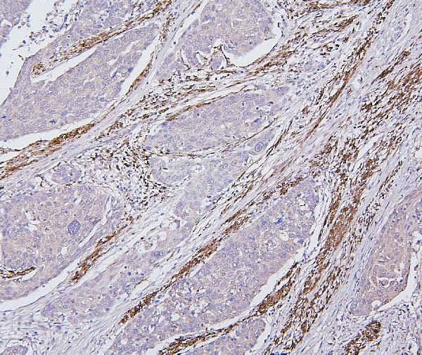 2 - Anti-Desmin Antibody Picoband™ (monoclonal, 2B5) ABO14885