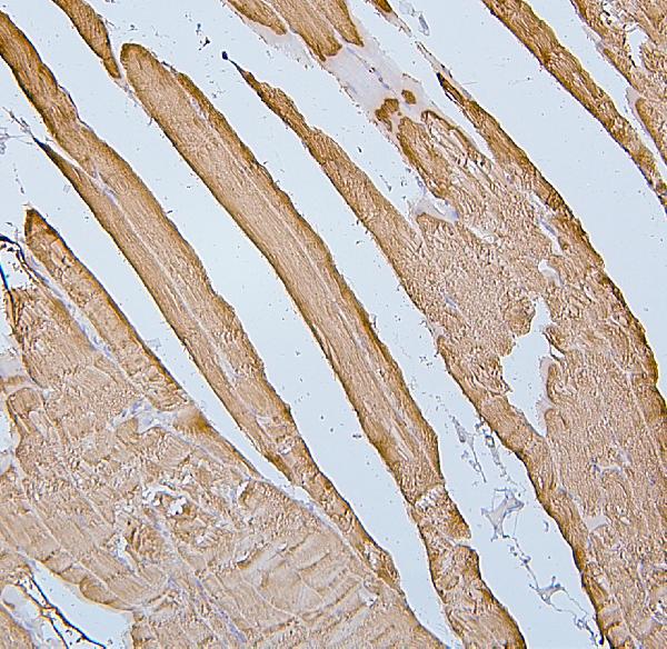 2 - Anti-Desmin Antibody Picoband™ (monoclonal, 2B5) ABO14885