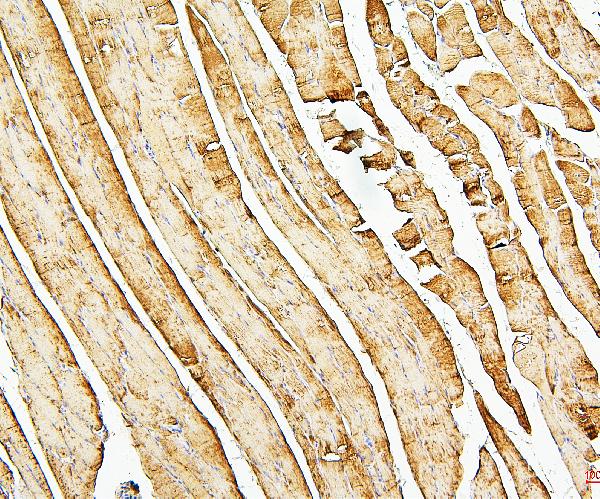 2 - Anti-Desmin Antibody Picoband™ (monoclonal, 2B5) ABO14885