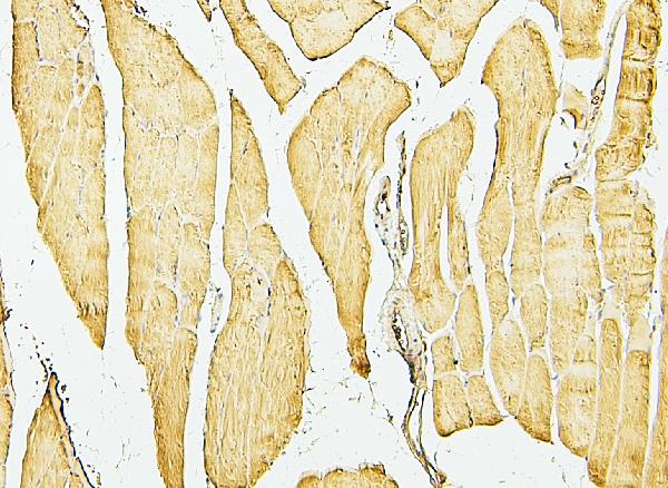 2 - Anti-Desmin Antibody Picoband™ (monoclonal, 2B5) ABO14885
